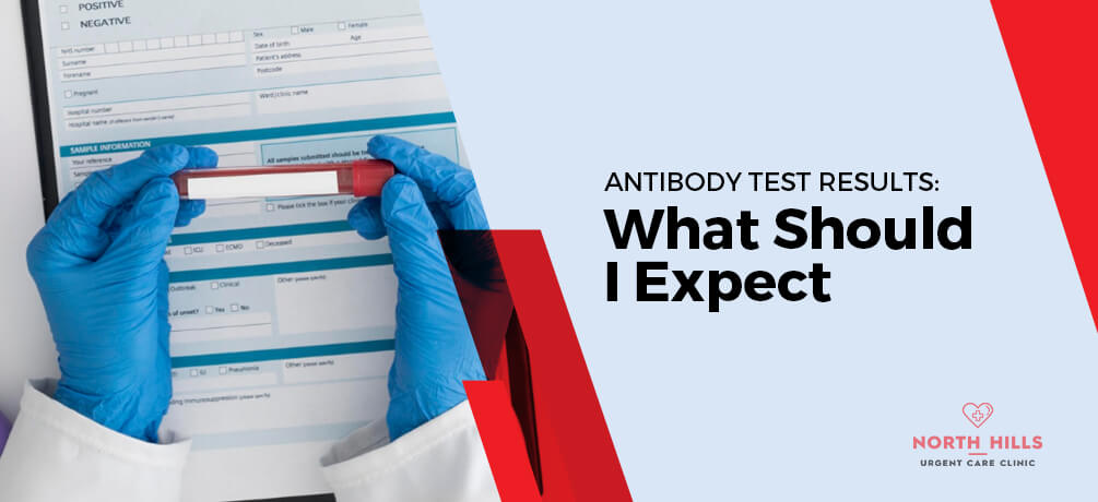Antibody Test Results