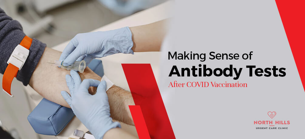 antibody test in north hills