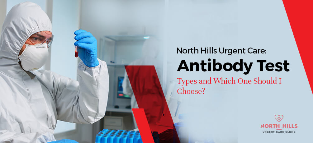 antibody test in North Hills